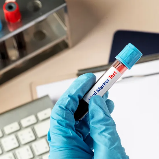 Book Viral Marker Test Price In Delhi Cost Near Me, India Ganesh